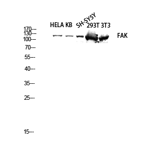 FAK Polyclonal Antibody