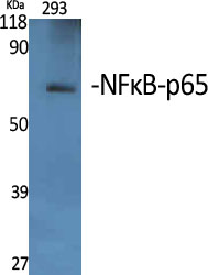 NFκB-p65 Polyclonal Antibody