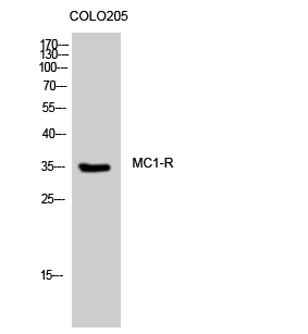 MC1-R Polyclonal Antibody