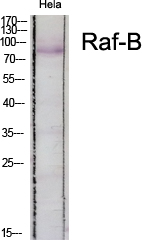 Raf-B Polyclonal Antibody