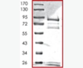 Recombinant Human Transforming Growth Factor β-1/TGFB1