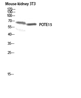 POTE15 Polyclonal Antibody