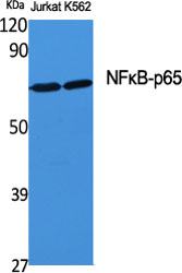 NFκB-p65 Polyclonal Antibody