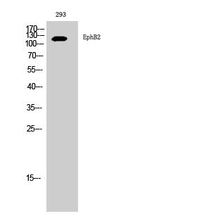 EphB2 Polyclonal Antibody