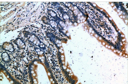 CKR-1 Polyclonal Antibody