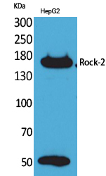 Rock-2 Polyclonal Antibody