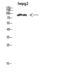 CACTIN Polyclonal Antibody