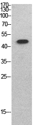 p53 Polyclonal Antibody