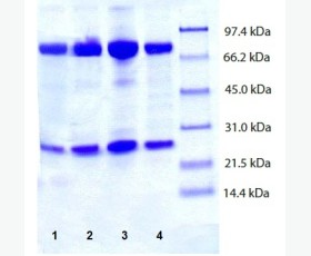 Recombinant Human C-C Motif Chemokine 24/CCL24/Eotaxin-2/MPIF-2