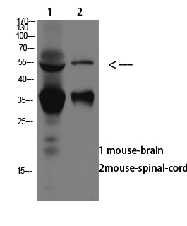 ASIC1 Polyclonal Antibody