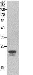 SRY Polyclonal Antibody