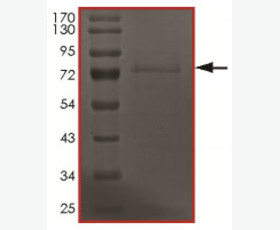 Recombinant Human Zinc Finger BED Domain-Containing Protein 1/ZBED1