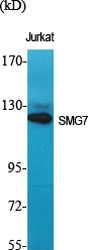 SMG7 Polyclonal Antibody