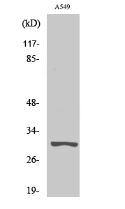 Trypsin-3 Polyclonal Antibody