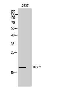 TUSC2 Polyclonal Antibody