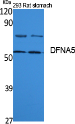 DFNA5 Polyclonal Antibody