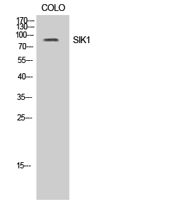 SIK1 Polyclonal Antibody