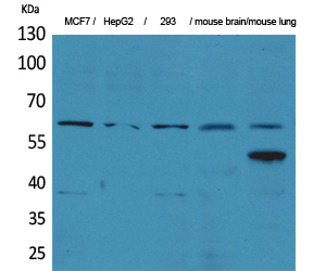 ZKSCAN4 Polyclonal Antibody