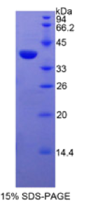 Recombinant Epidermal Growth Factor Receptor (EGFR)