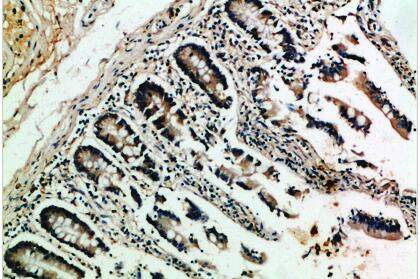 NFATc2 Polyclonal Antibody