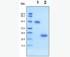 Recombinant Mouse TRANCE/RANK L/TNFSF11