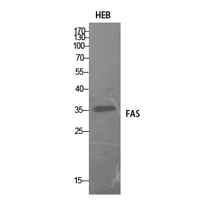 FAS Polyclonal Antibody