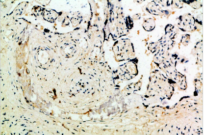 Ob Polyclonal Antibody