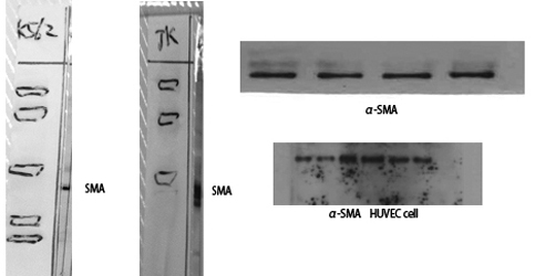 α-SMA Polyclonal Antibody