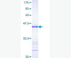 Recombinant Mouse Kallikrein 7/KLK7