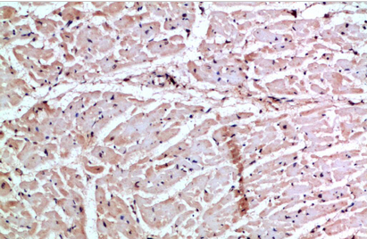 GROγ Polyclonal Antibody