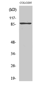 TLK2 Polyclonal Antibody