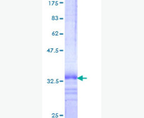 Recombinant Human Sedoheptulokinase/SHPK