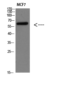 Parathyroid hormone/parathyroid hormone-related peptide receptor Polyclonal Anti