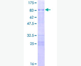 Recombinant Human α-Galactosidase/GLA