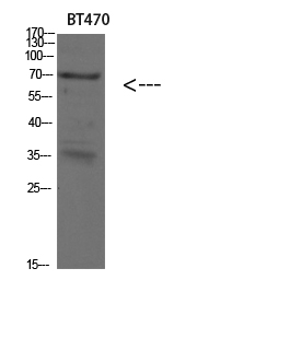 Cytokeratin 4 Polyclonal Antibody