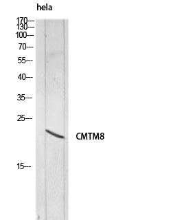 CMTM8 Polyclonal Antibody