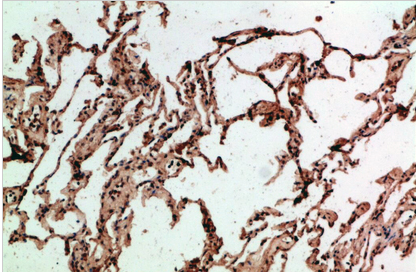 ADI1 Polyclonal Antibody