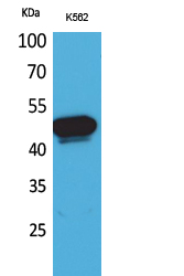 Kallistatin Polyclonal Antibody