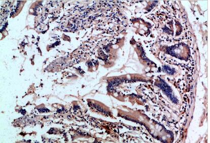 CD242 Polyclonal Antibody