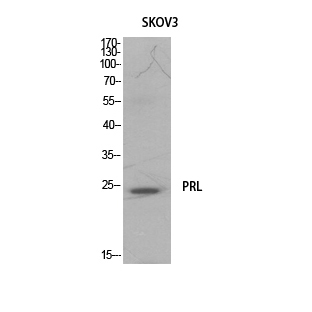 Prolactin Polyclonal Antibody