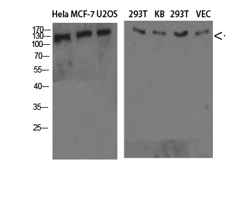 Collagen IV Polyclonal Antibody