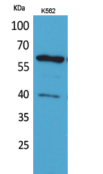 CYP11A1 Polyclonal Antibody