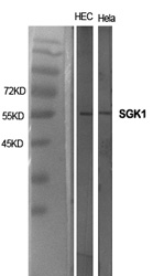 SGK1 Polyclonal Antibody