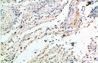 Versican Polyclonal Antibody