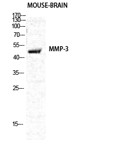 MMP-3 Polyclonal Antibody