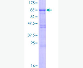 Recombinant Human C-X-C Motif Chemokine 14/CXCL14