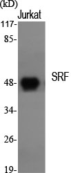 SRF Polyclonal Antibody