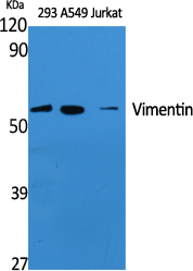 Vimentin Polyclonal Antibody