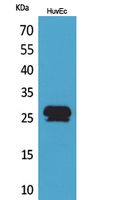 CacyBP Polyclonal Antibody