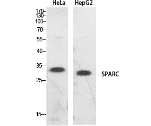 SPARC Polyclonal Antibody